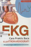 Cara Praktis Baca Elektrokardiografi: EKG