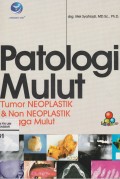 Patologi Mulut: Tumor Neoplastik & Non Neoplastik Ronggs Mulut