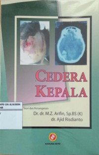 Cedera Kepala