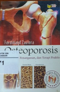 Osteoporosis : Deteksi Dini, Penanganan, dan Terapi Praktis