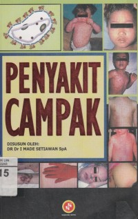 Penyakit campak