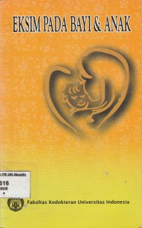 Image of Eksim Pada Bayi & Anak