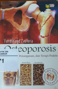 Image of Osteoporosis : Deteksi Dini, Penanganan, dan Terapi Praktis