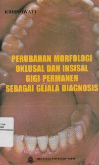 Image of Perubahan Morfologi Oklusal dan Insisal Gigi Permanen Sebagai Gejala Diagnosis